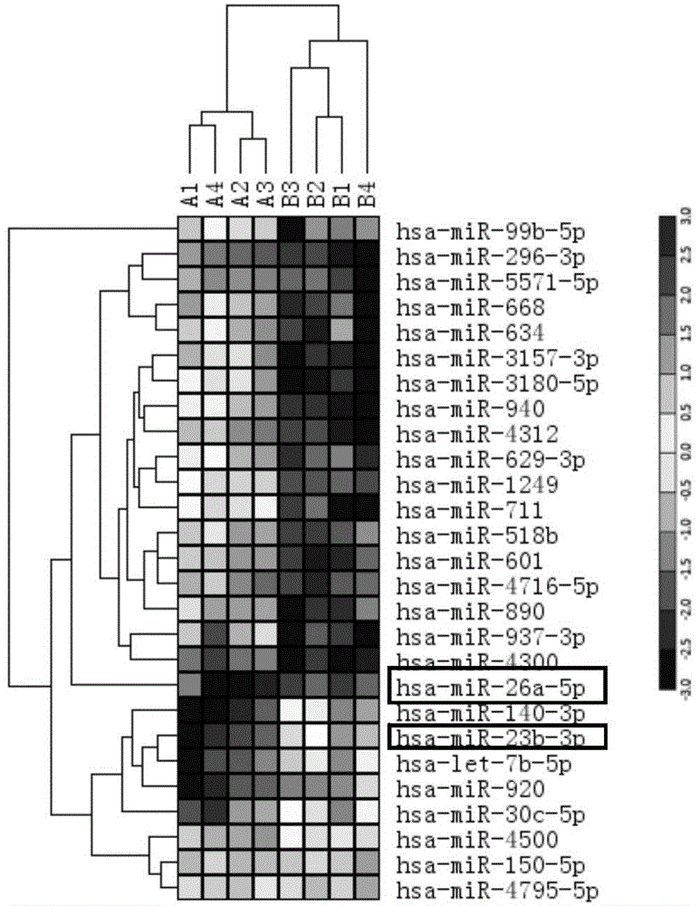 Micro ribonucleic acid (miRNA) marker group related to acute myelogenous leukemia, and specific primer and application of marker group