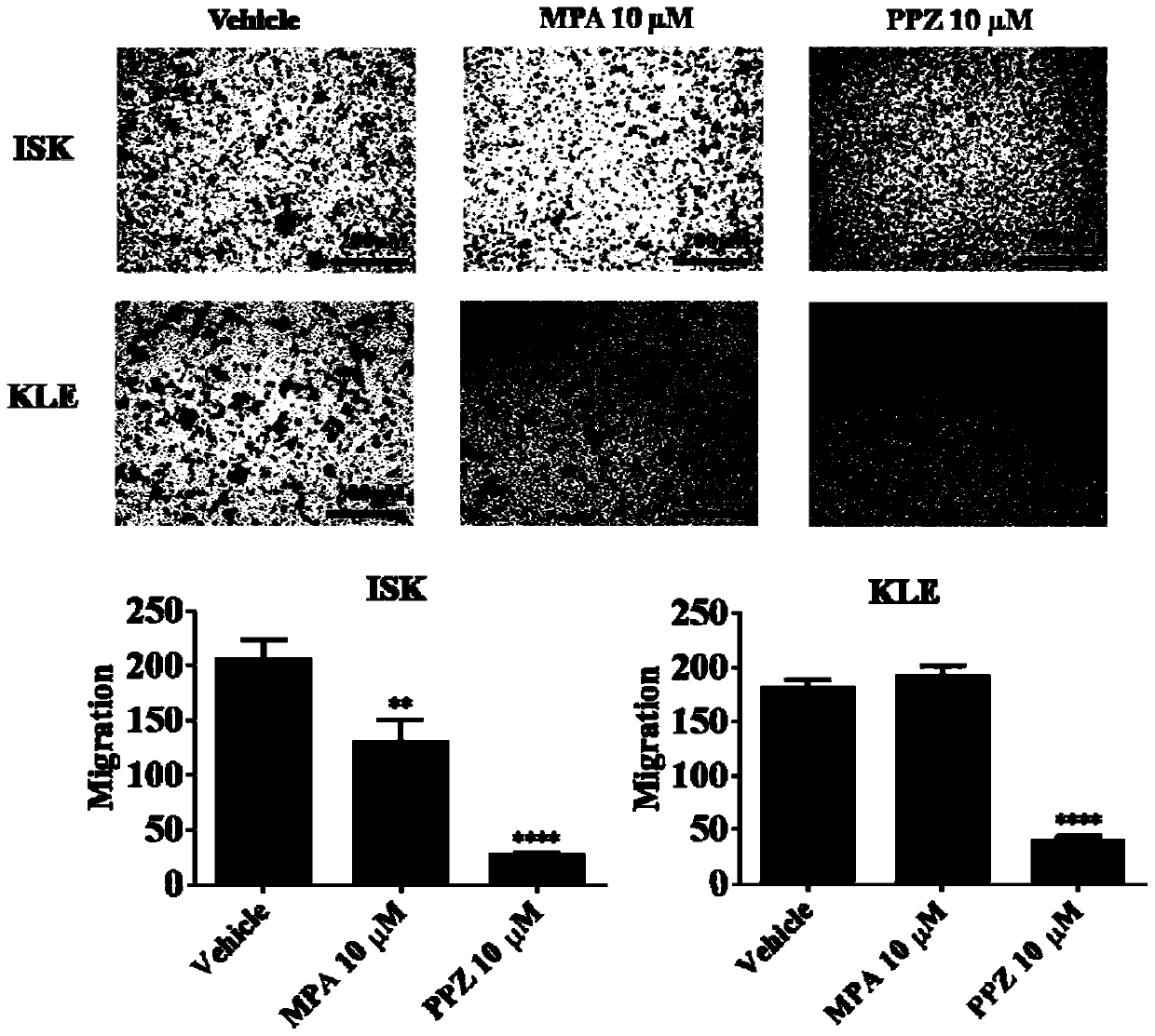 Application of perphenazine in preparing medicament for treating endometrial carcinoma