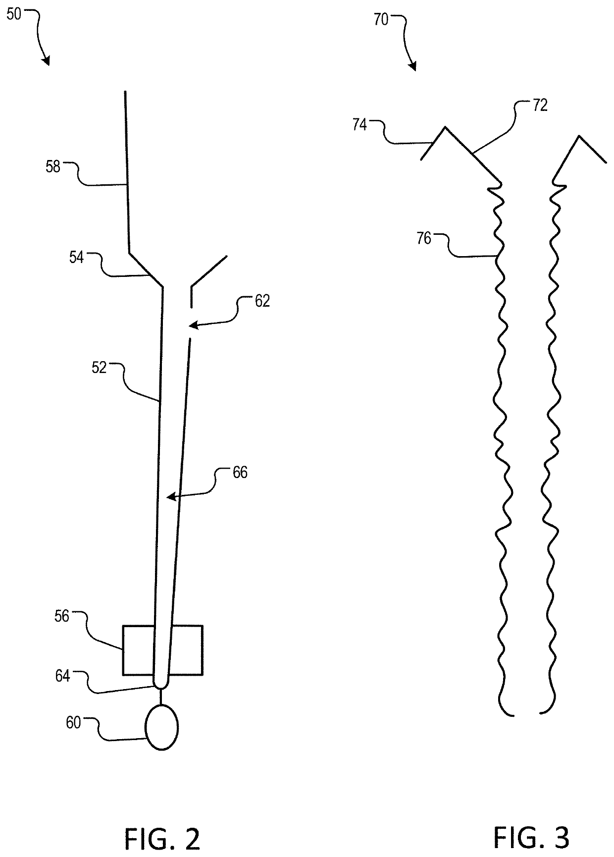 Methods and devices for gastricintestinal tract bypass