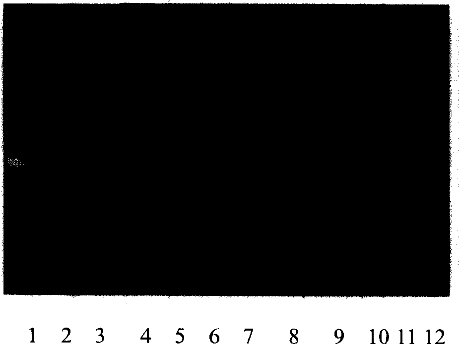 Multiple real time fluorescence quantifying PCR method for detecting porcine circovirus, porcine parvovirus, porcine pseudorabies virus and classical swine fever virus