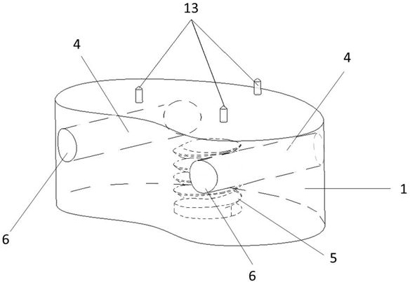 High-simulation customized combined artificial vertebra