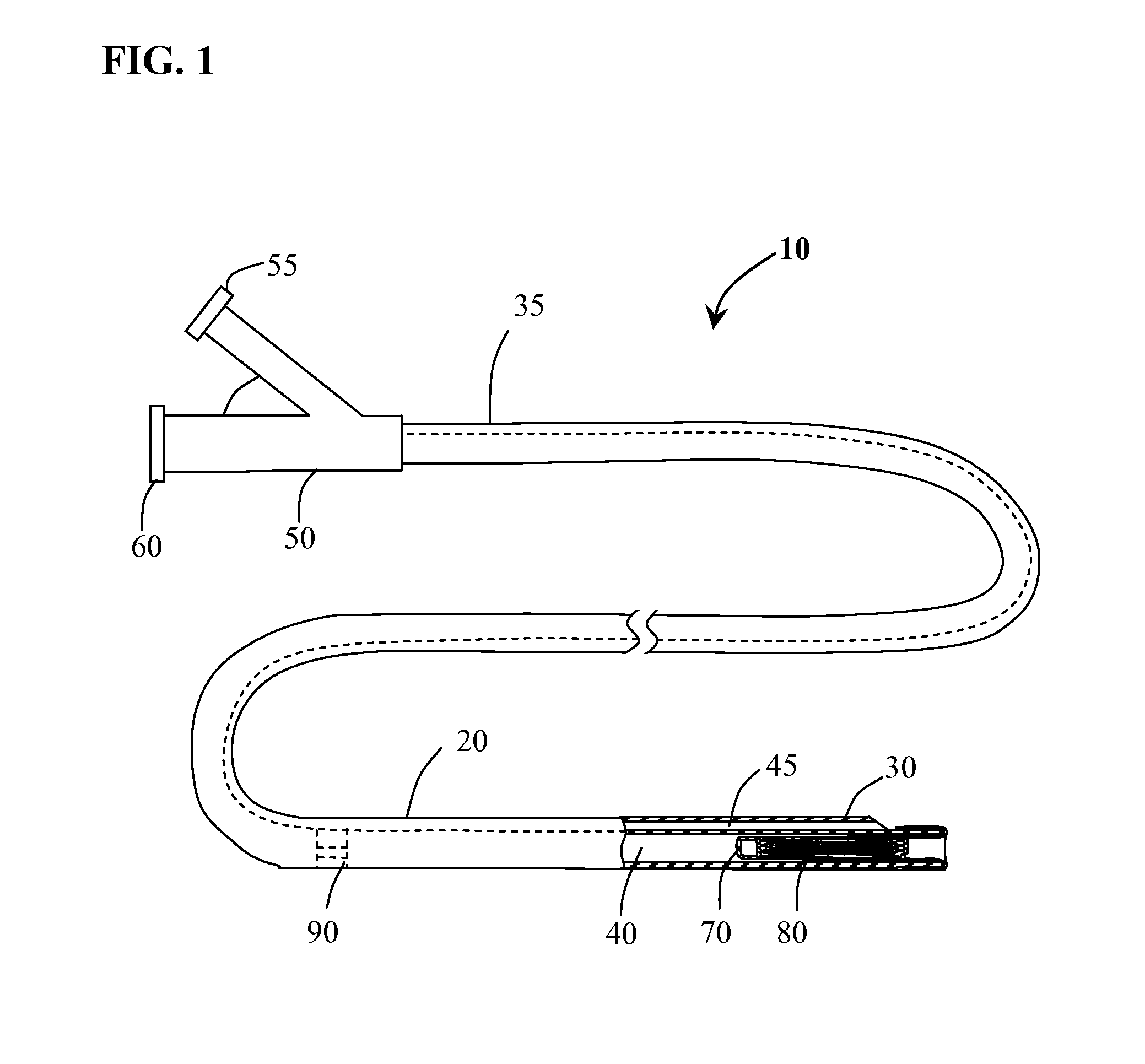 Systems and devices for intralumenal implantation