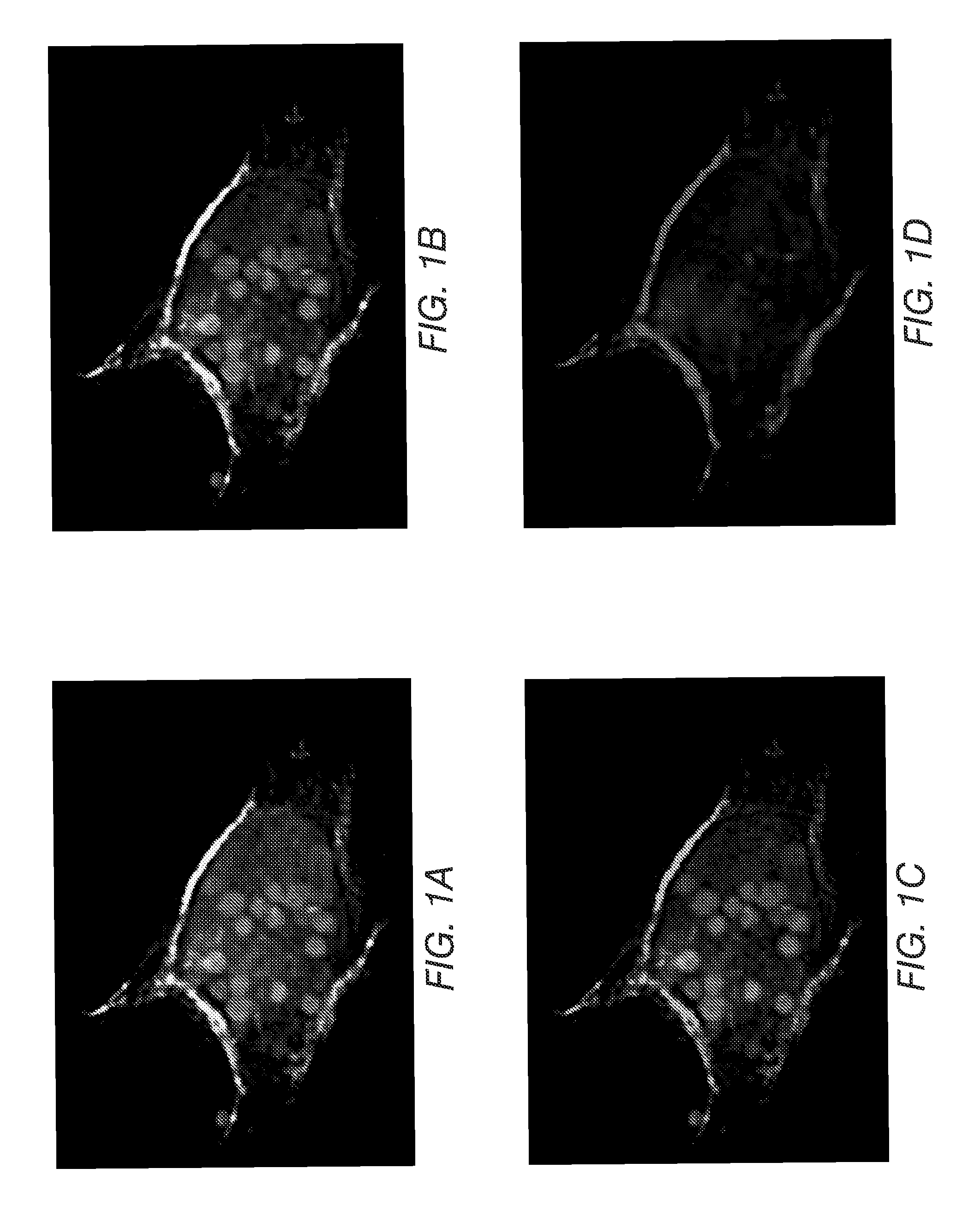 Method for detecting multi-drug resistance