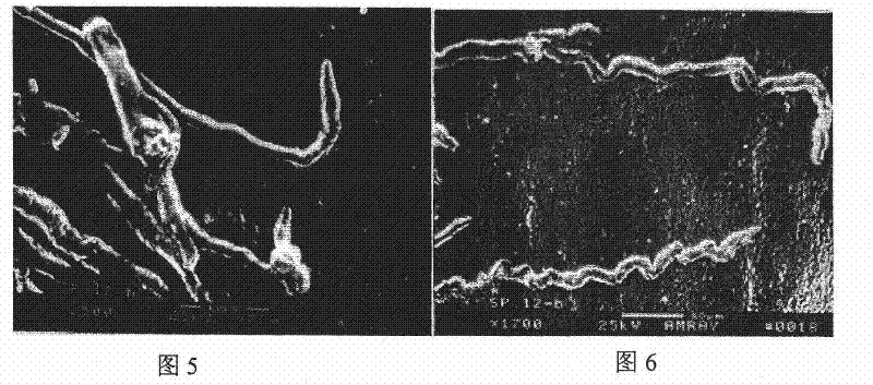 Streptomyces strain for preventing rice sheath disease and rice blast disease