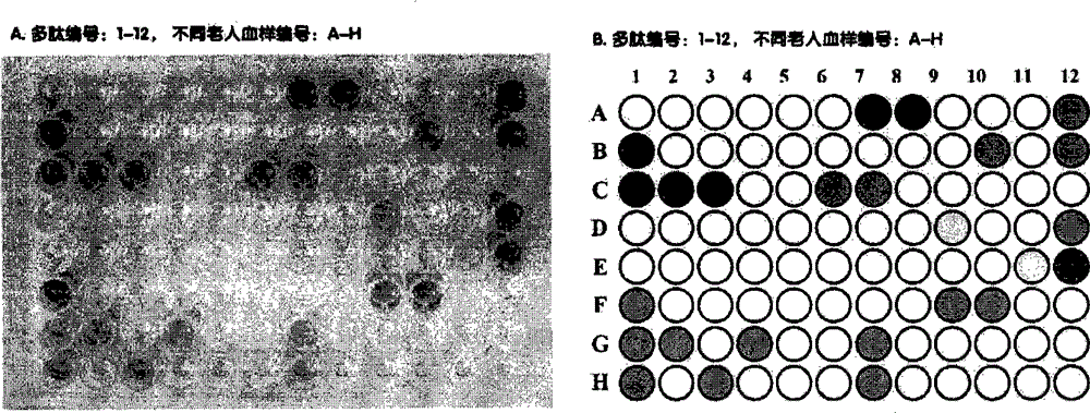 Method for preparing anti-human R47H-TREM2 mutant human monoclonal antibody