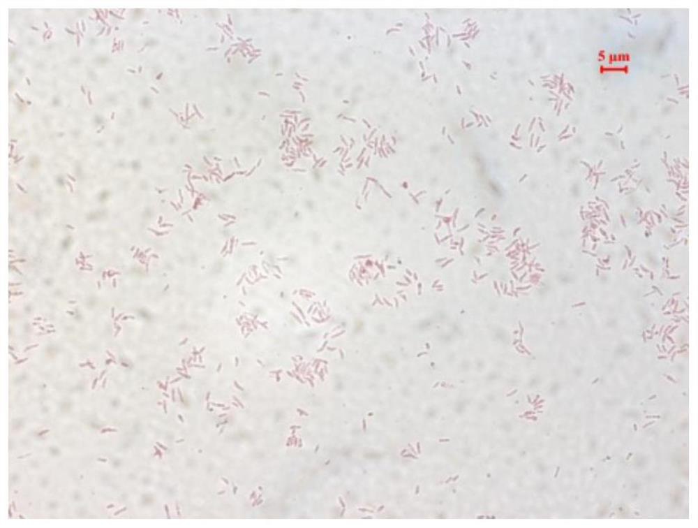 Saline-alkali soil resistant nitrogen fixation rhizobium japonicum and application thereof