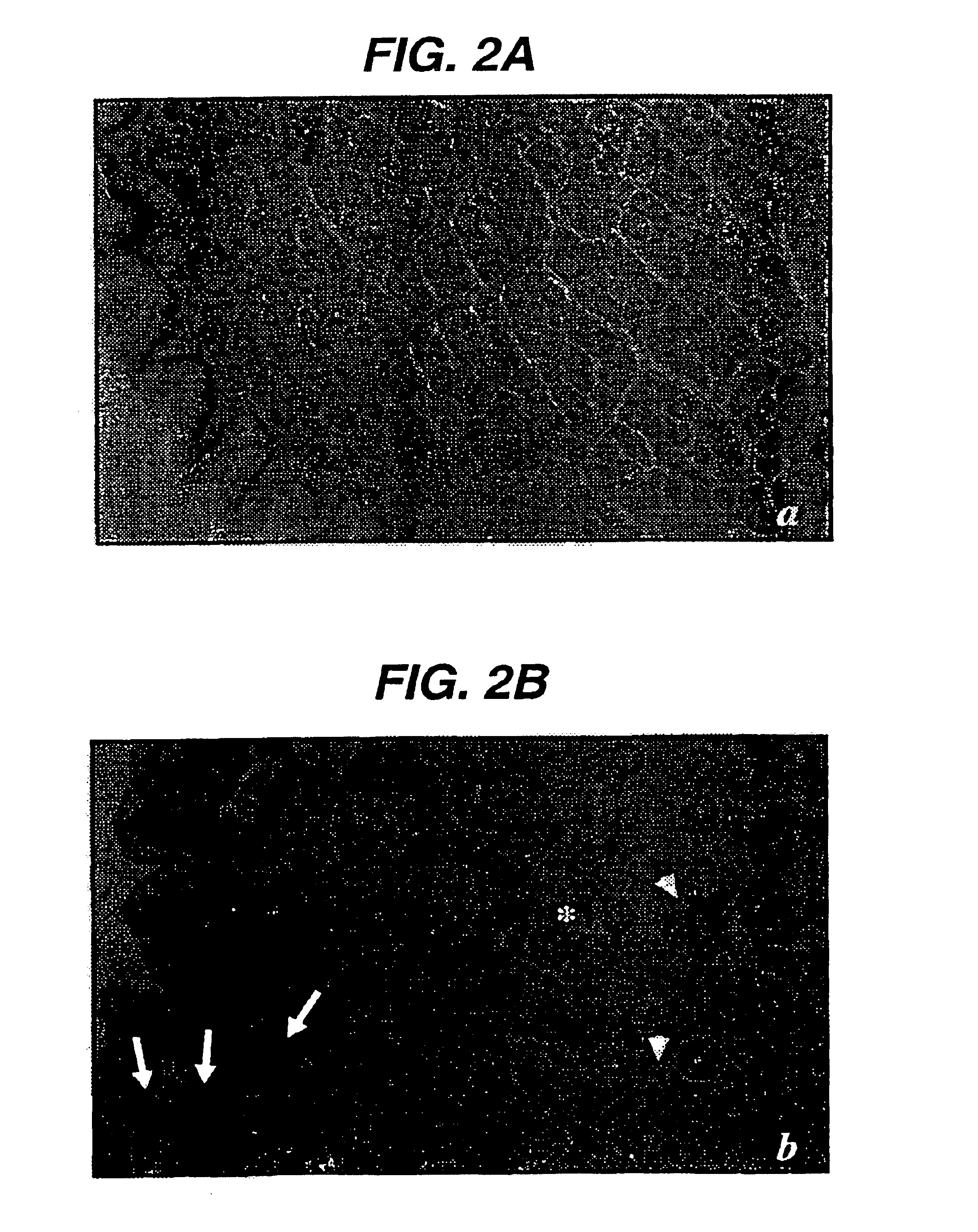 Immunization against and treatment for infection by H. pylori