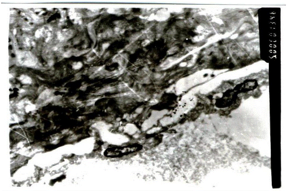 Medicinal composition as well as preparation method and applications thereof