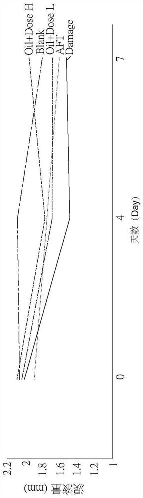 Application of medical composition in preparing medicine for treating xerophthalmia