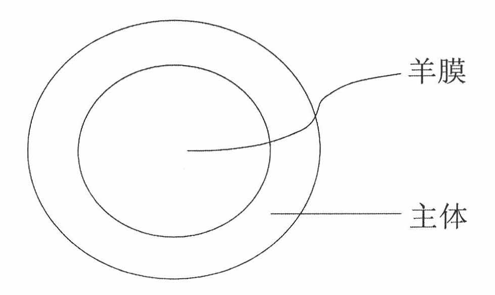 Method for preparing contact lens-shaped amniotic dressing