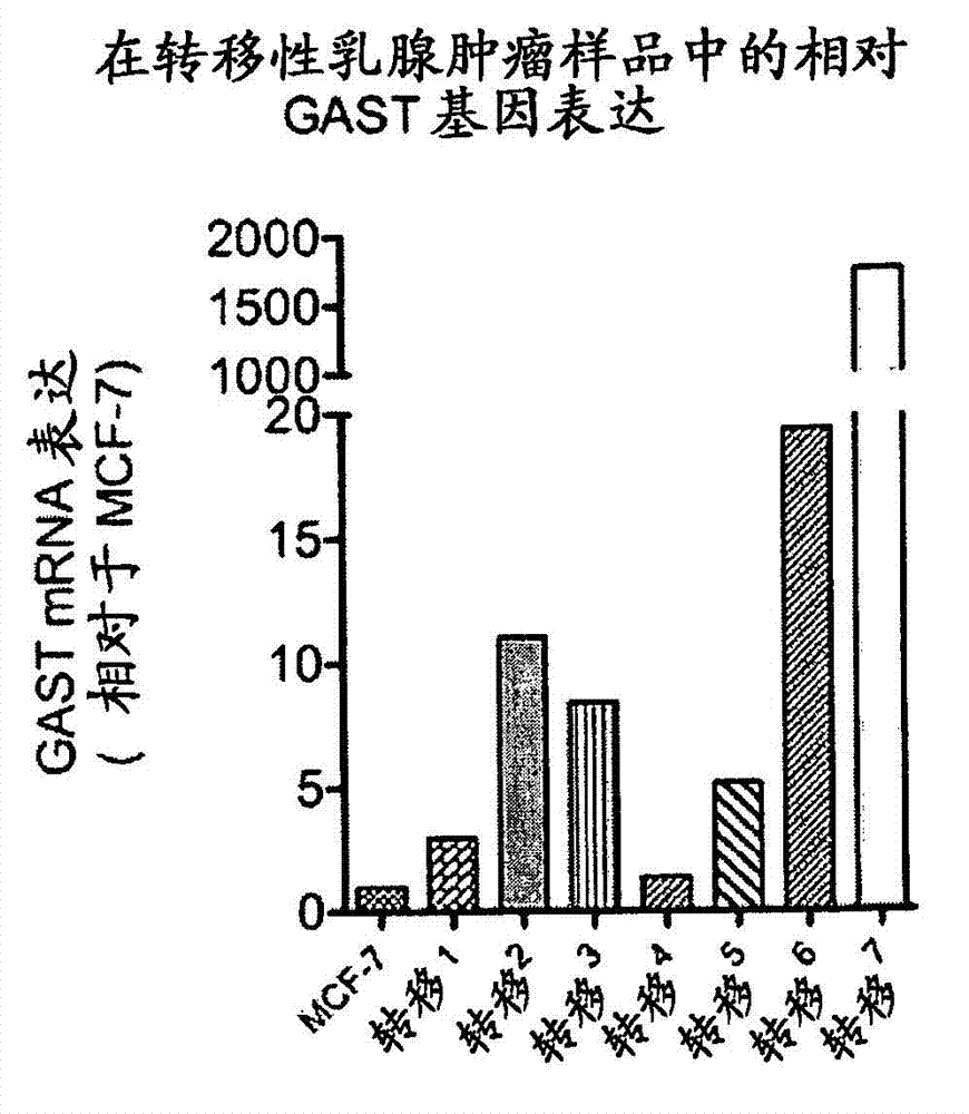 Methods for treating breast cancer