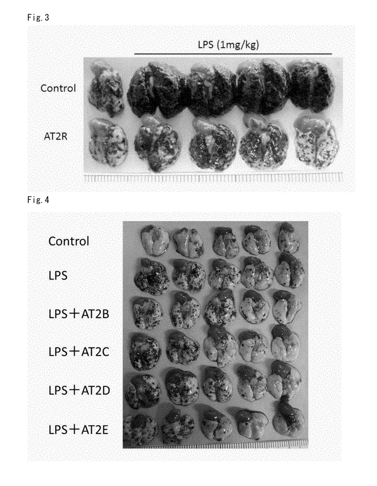 Medicament for suppressing malignant tumor metastasis