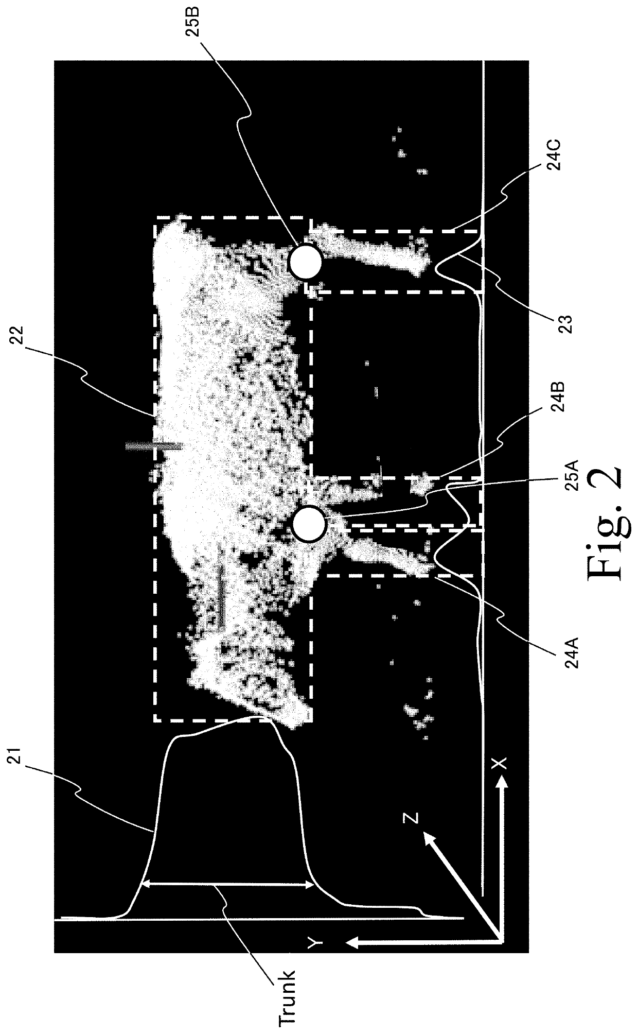 Health condition estimation device