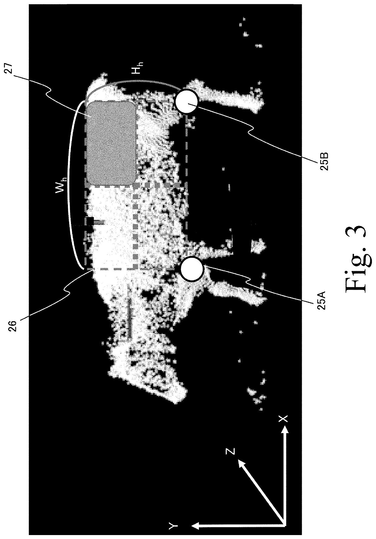 Health condition estimation device