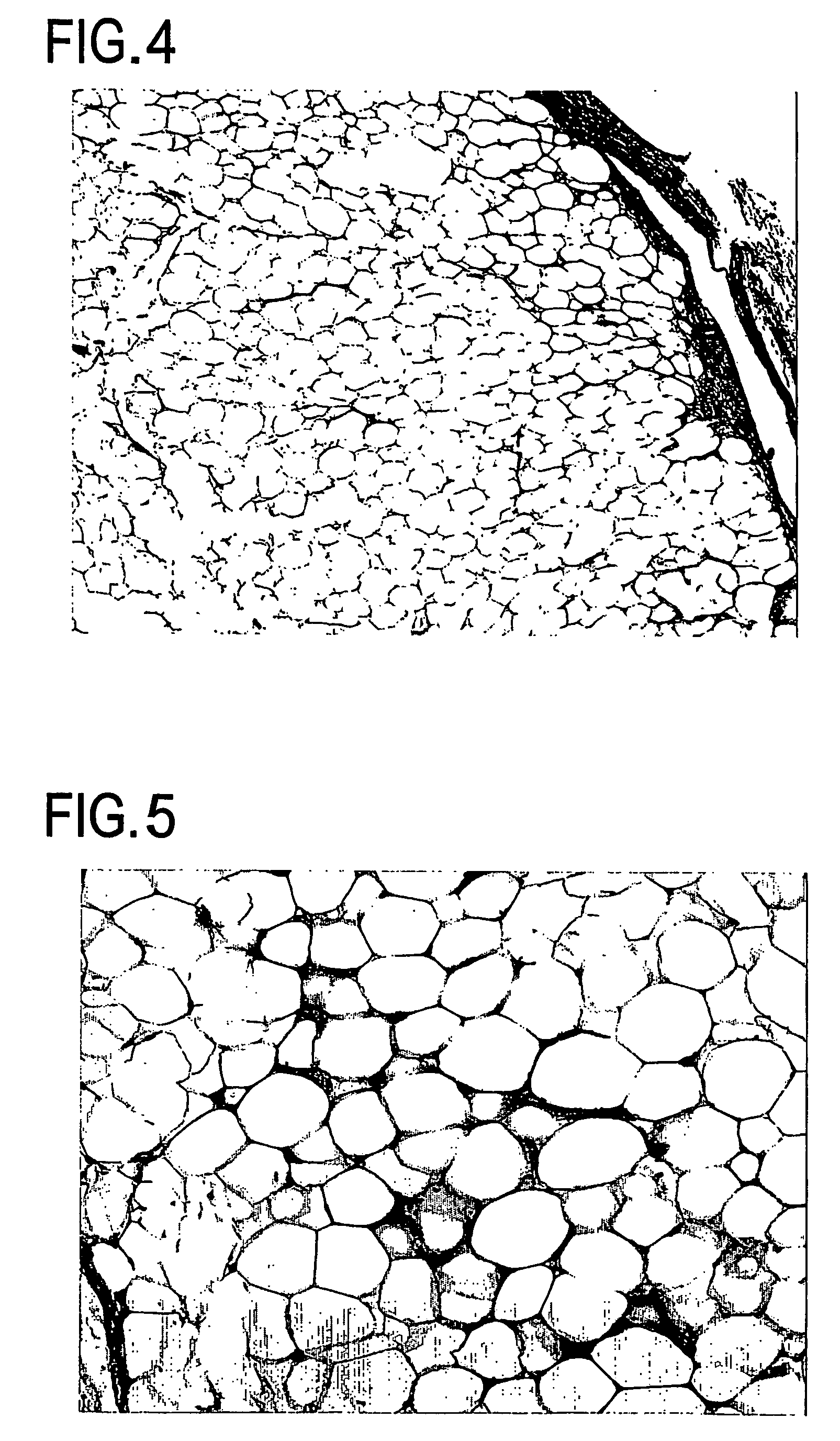 Cell differentiation of adipose-derived precursor cells