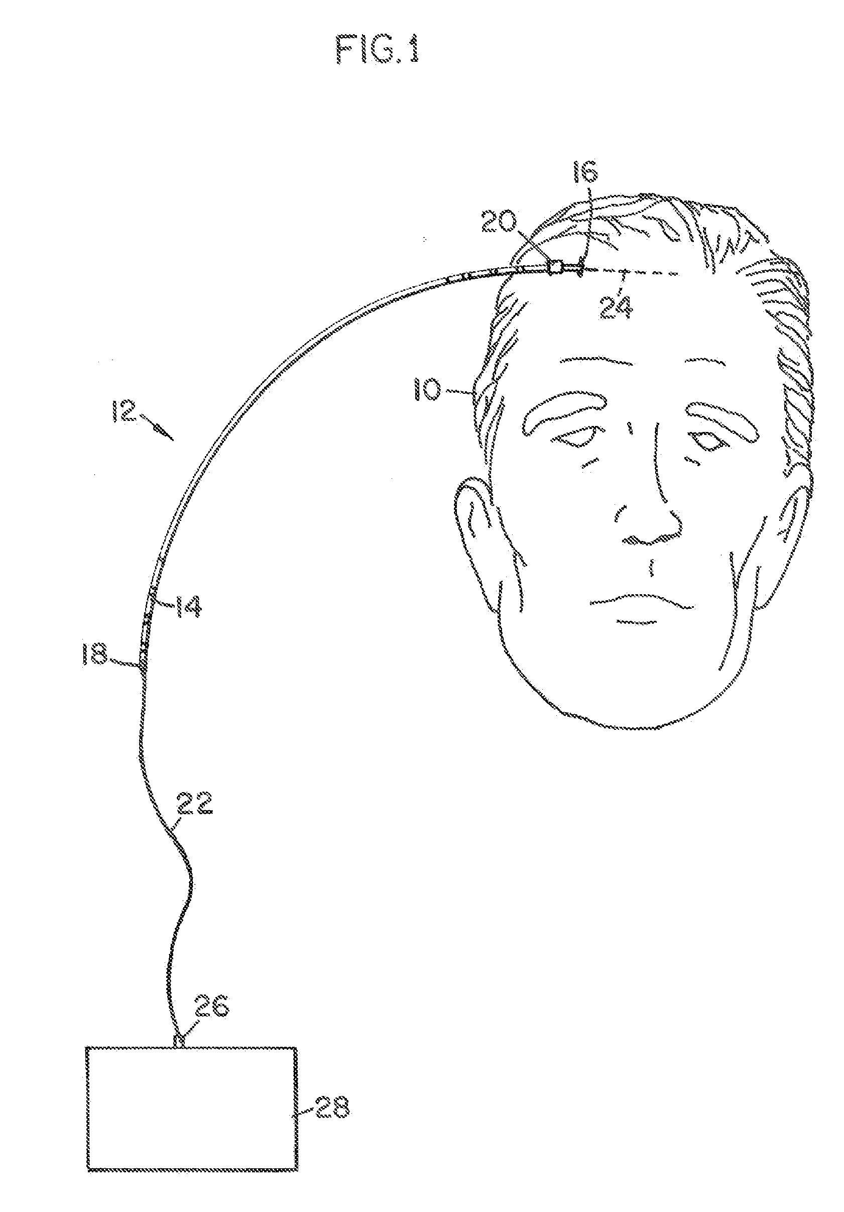 Infusion device and method for infusing material into the brain of a patient