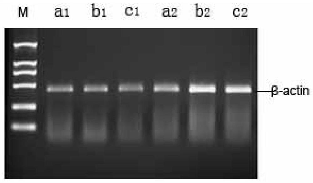 A deep cryogenic freezing method for tumor tissue blocks