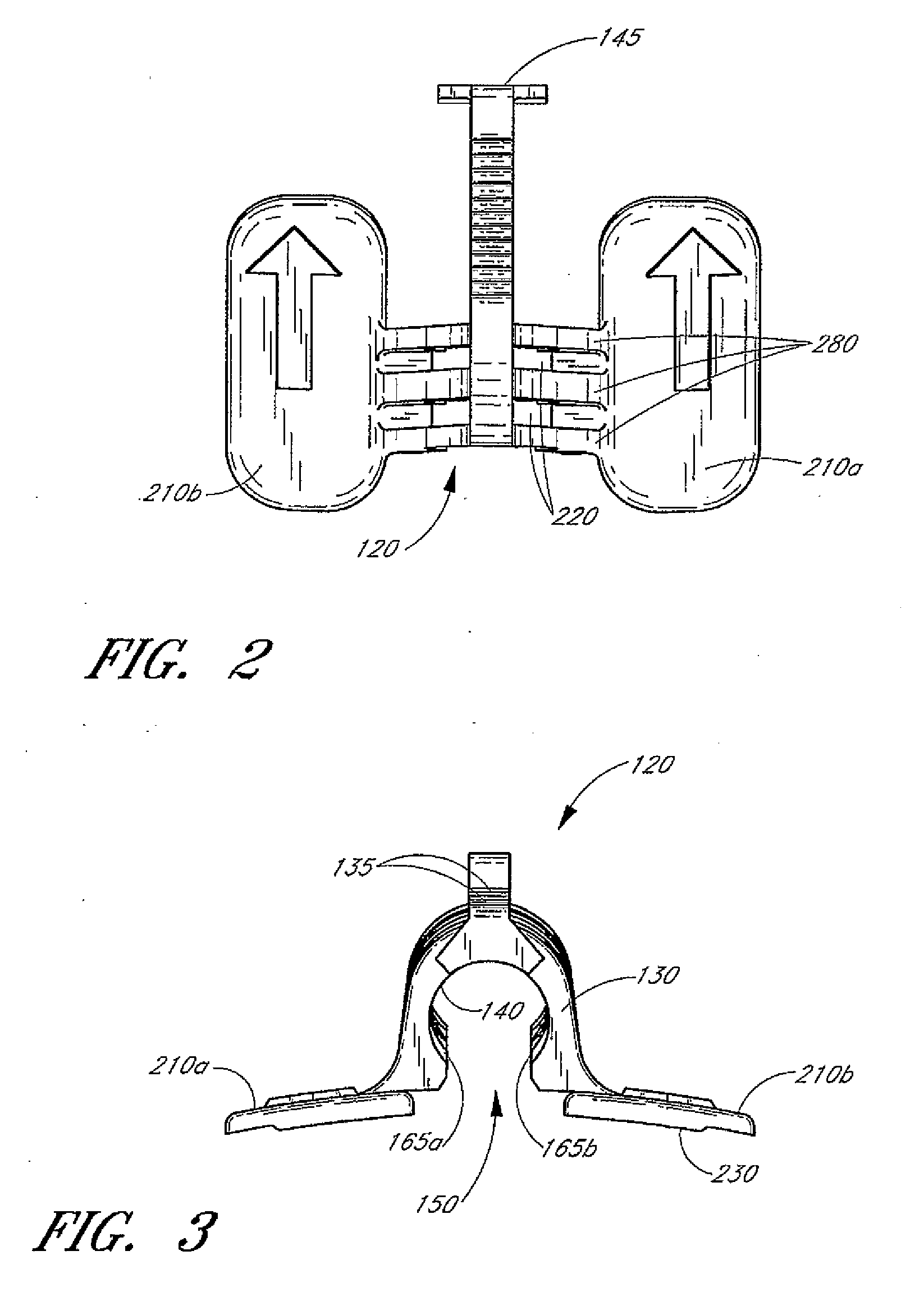 Catheter securement device