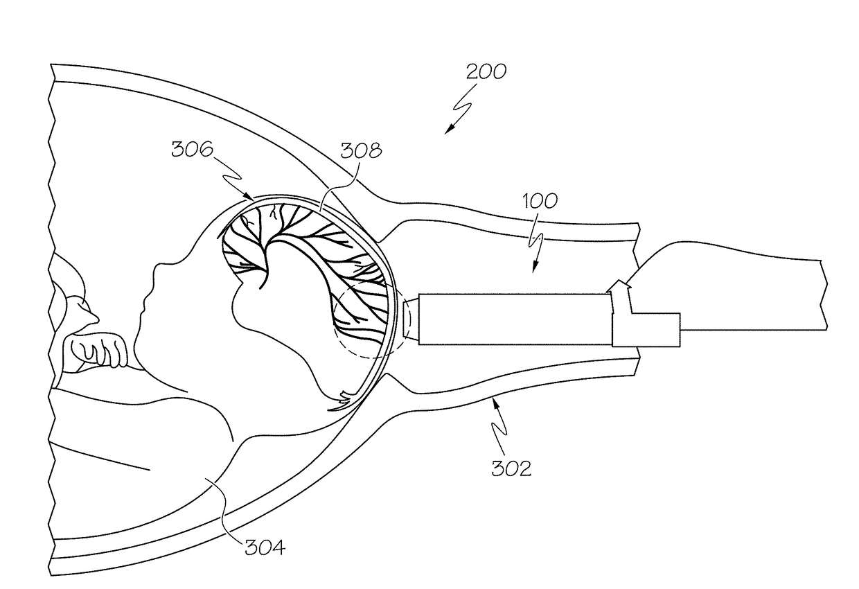 Ultrasound and photoacoustic systems and methods for fetal brain assessment during delivery