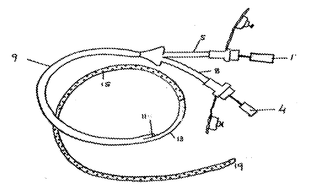 Enteral feeding tube