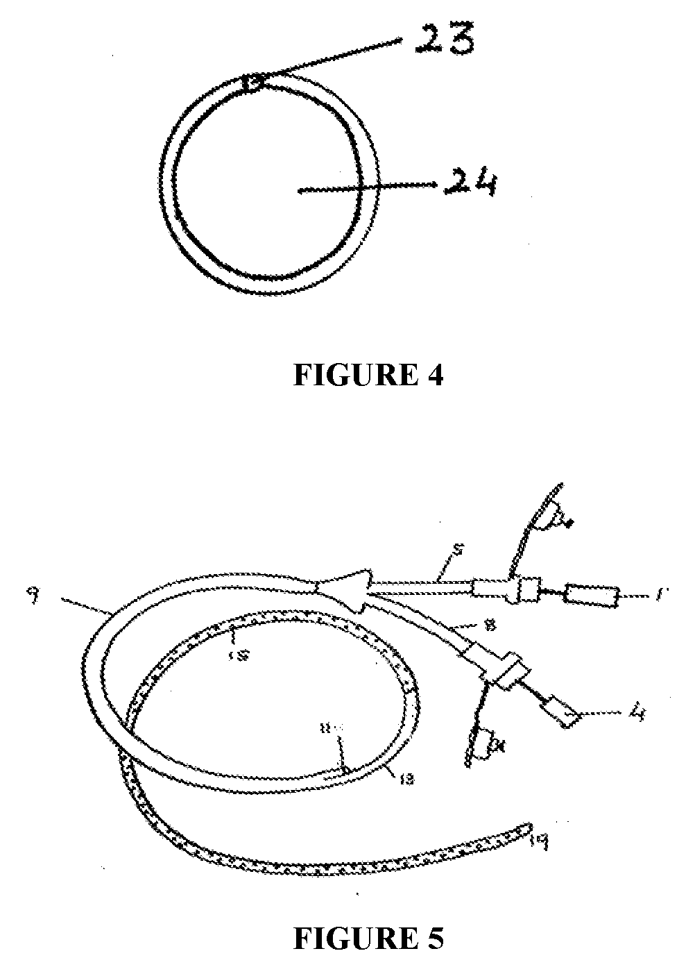 Enteral feeding tube