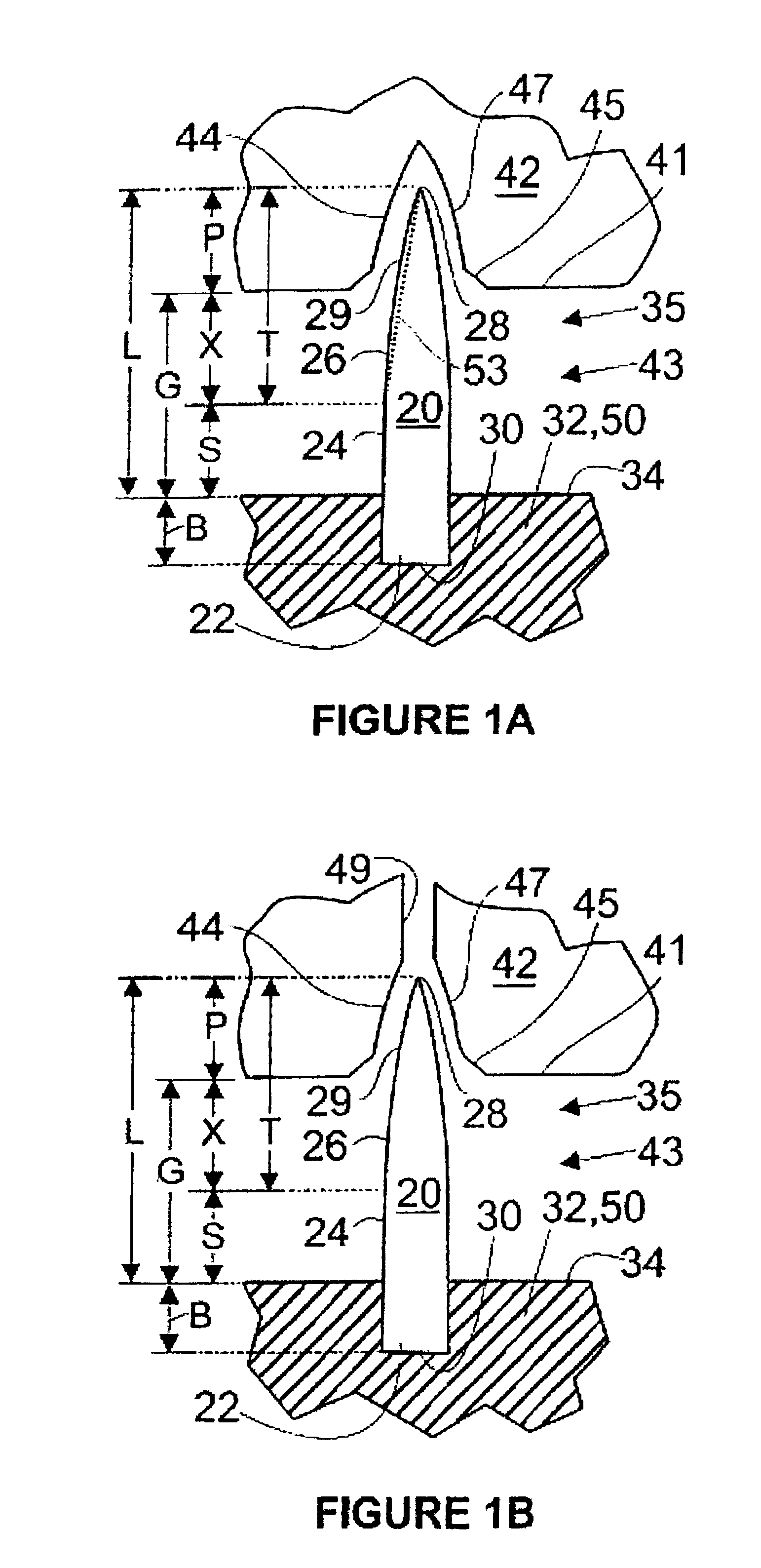 System for aperturing and coaperturing webs and web assemblies