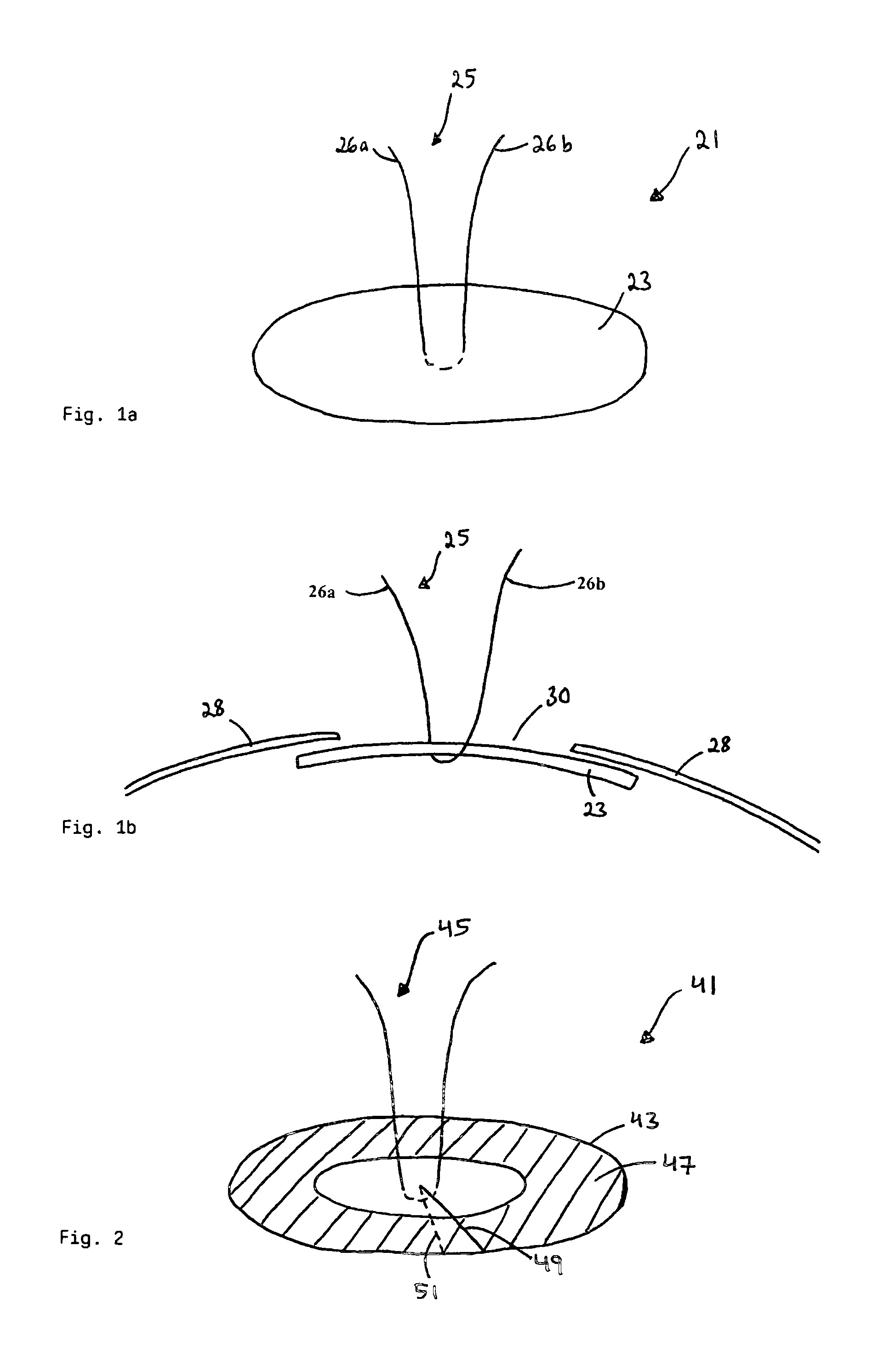 Device for use in eye surgery