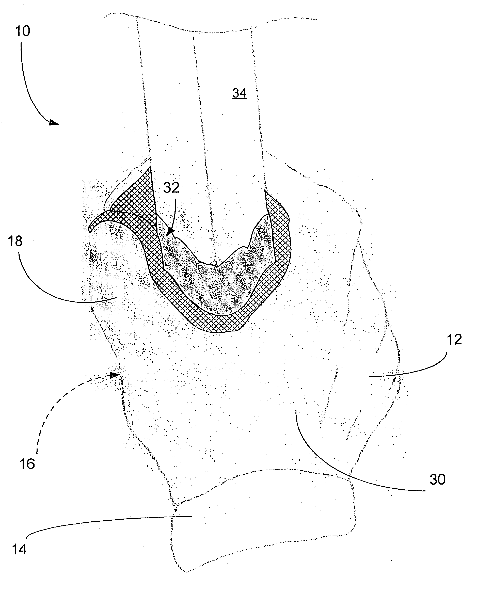 Applicator device for paint and surface coatings