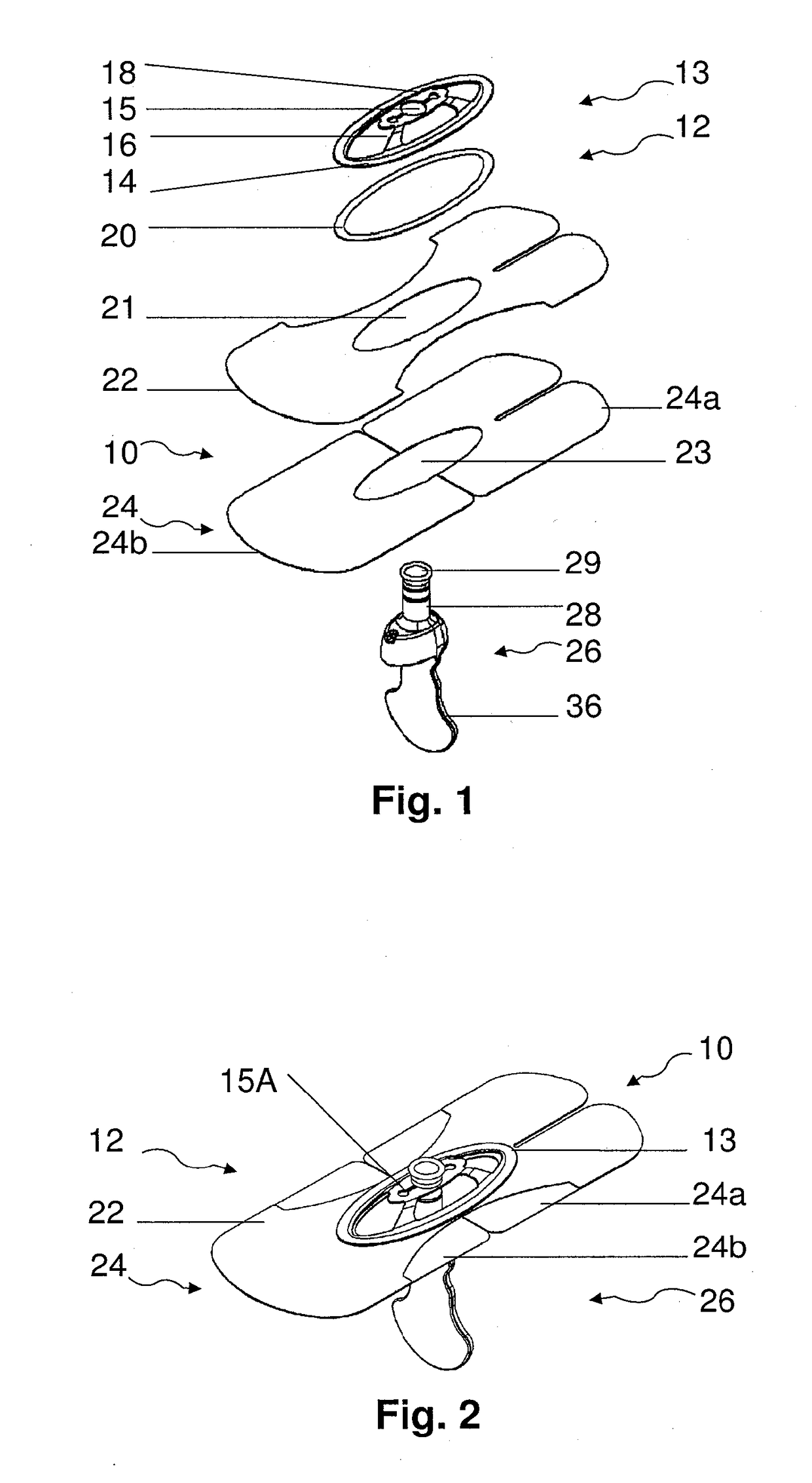 A method and device for external urinary incontinence treatment for women