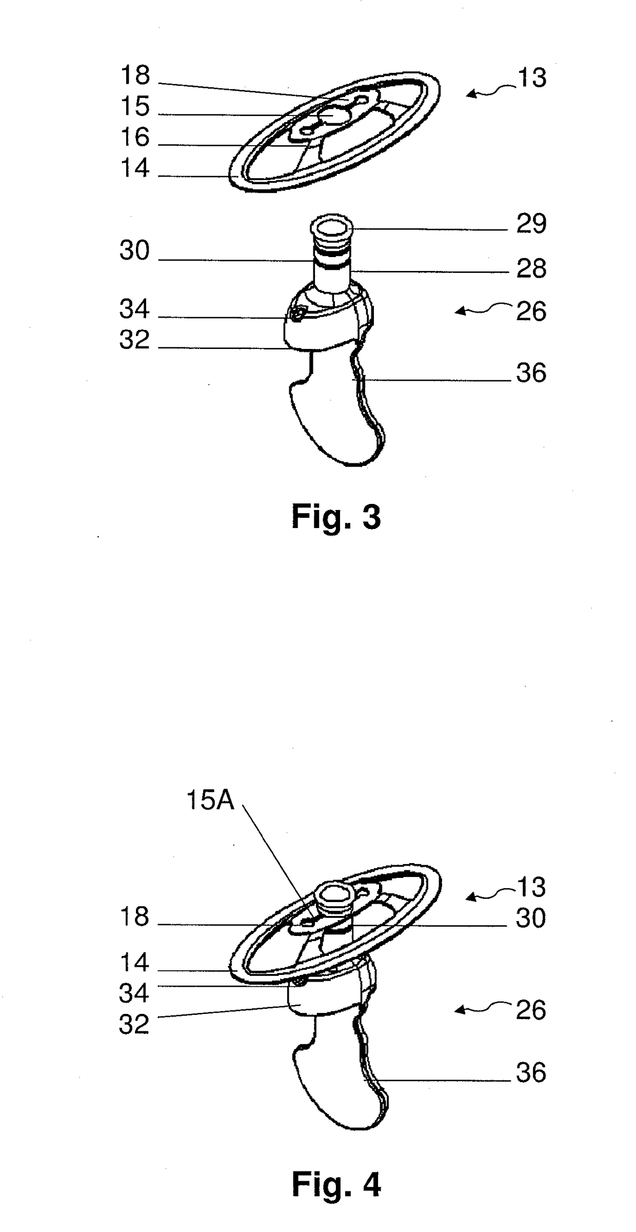 A method and device for external urinary incontinence treatment for women