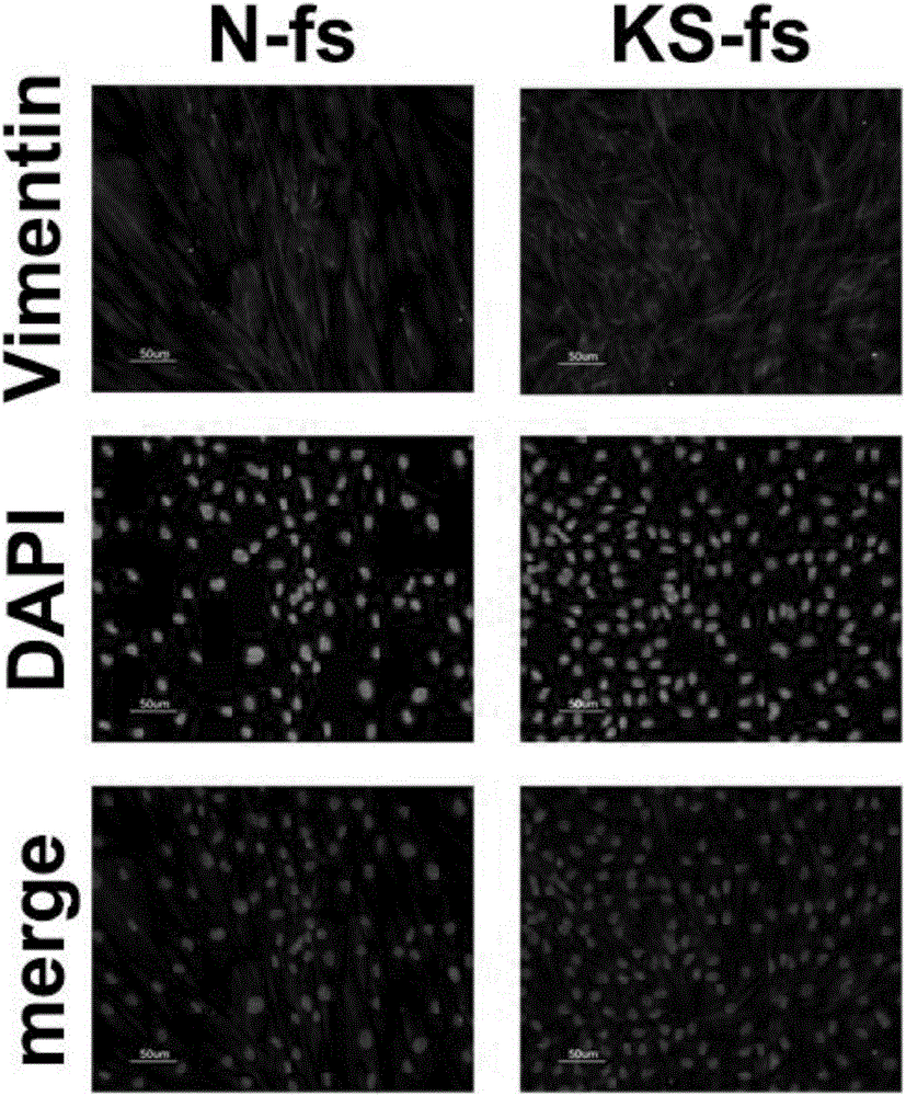 Separation and primary culture method for human skin fibroblasts