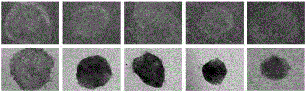 Separation and primary culture method for human skin fibroblasts