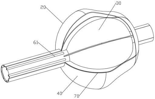 Catheters and ablation systems that can determine where the balloon is attached