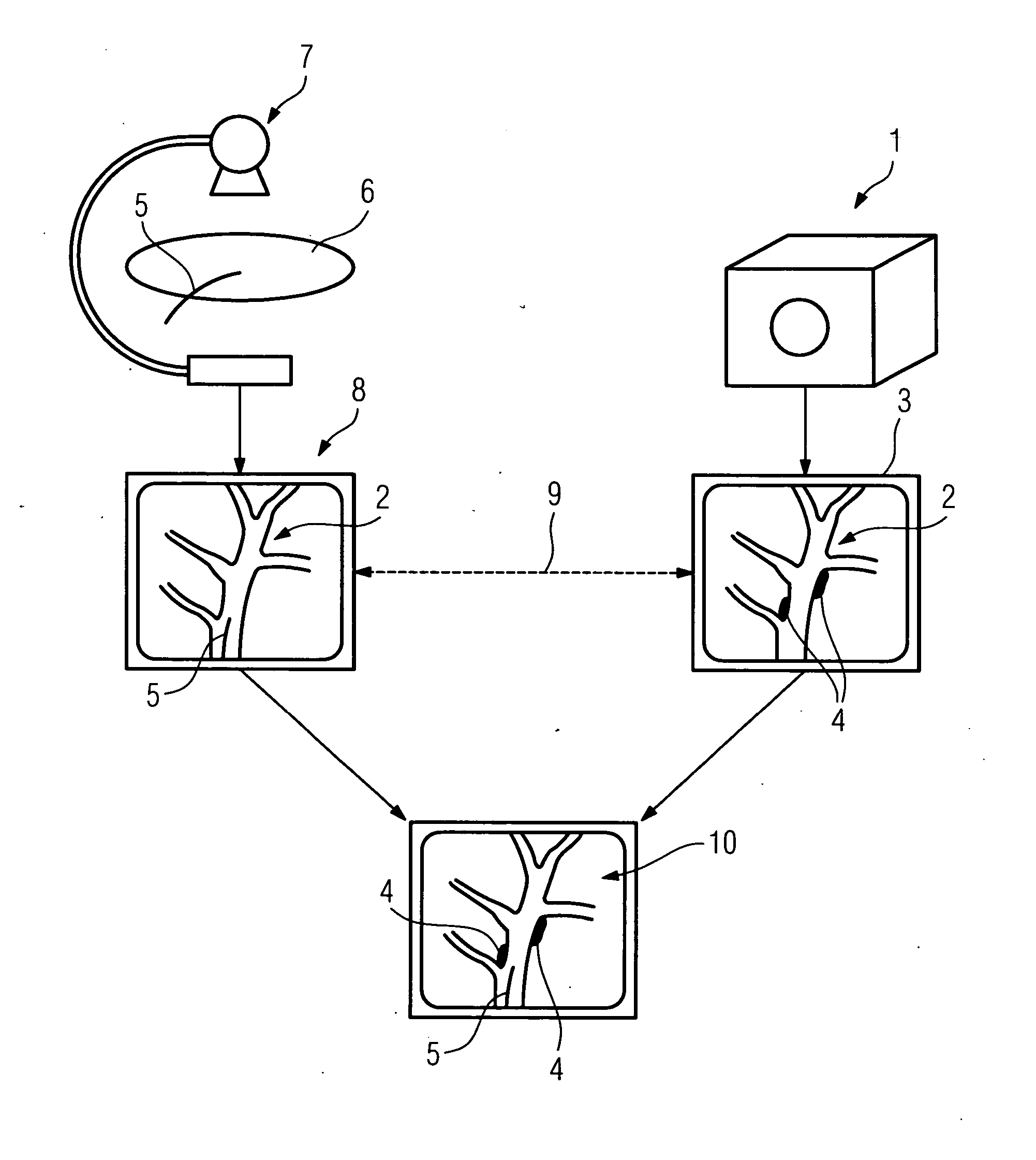 Method for supporting navigation of a medical instrument, in particular of a catheter