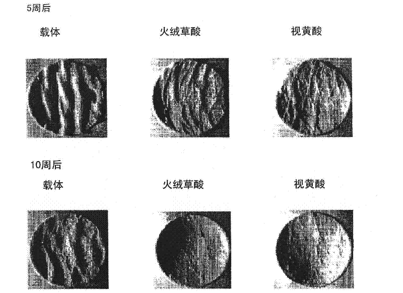 Anti-wrinkle cosmetic skin composition containing leontopodic acid as an active ingredient