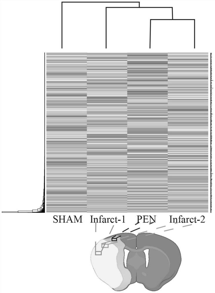 Application of circular RNA CircOGDH as acute ischemic stroke treatment target