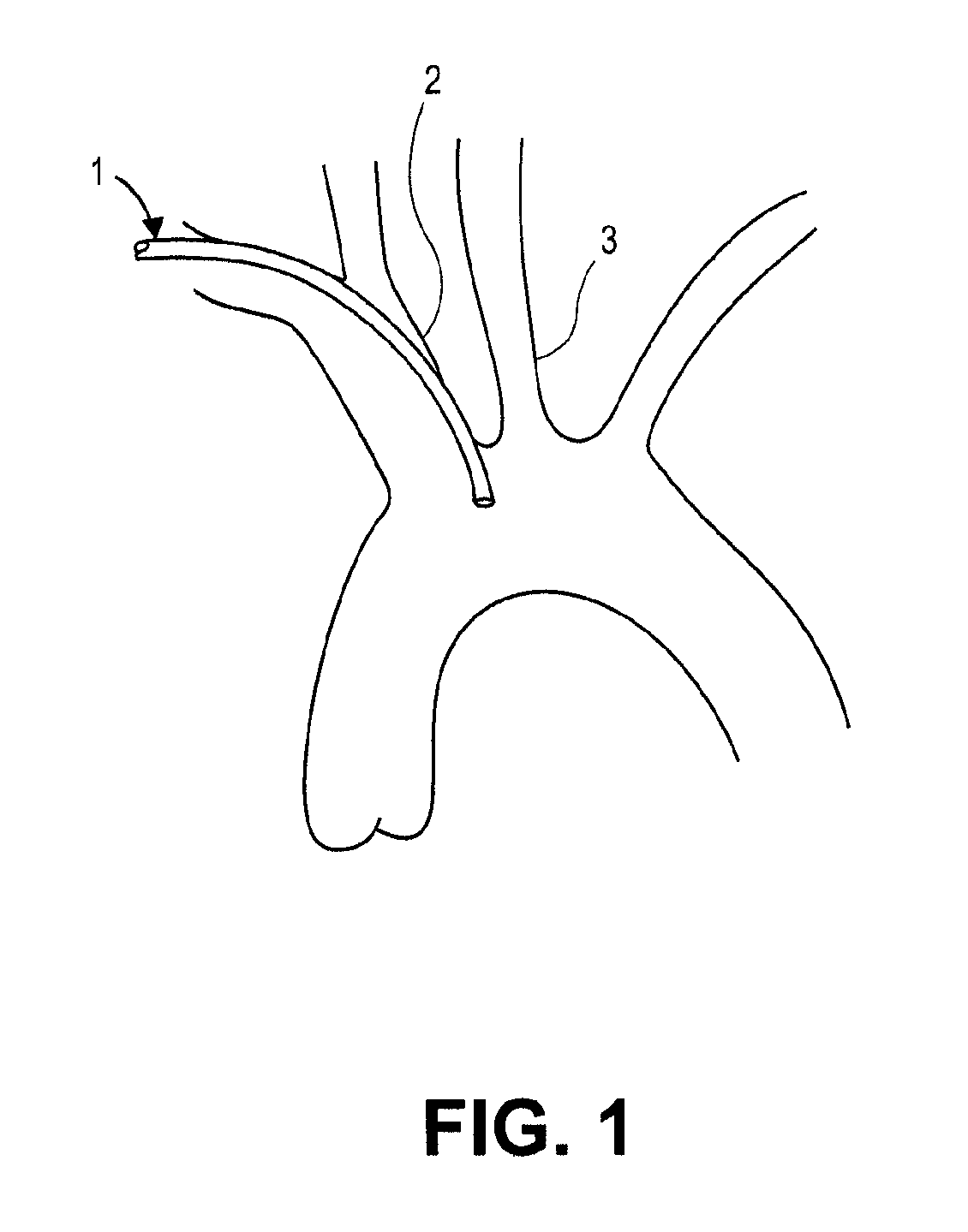 Intravascular blood filters and methods of use