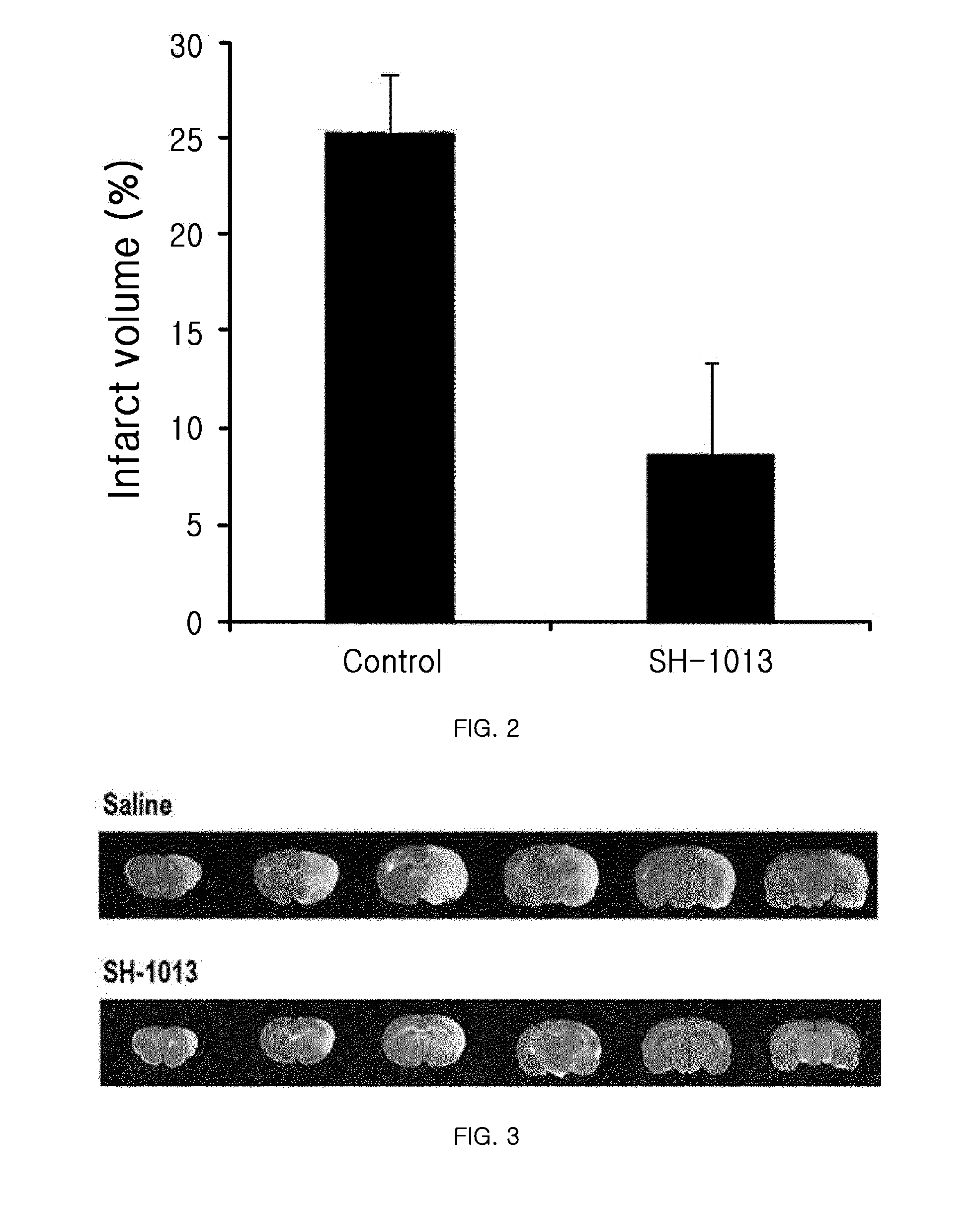 Pharmaceutical Composition or Health Food Comprising Lonicera Coerulea Var. Edulis Fruit Extracts as Active Ingredients for Preventing or Improving Ischemic Cerebrovascular Diseases