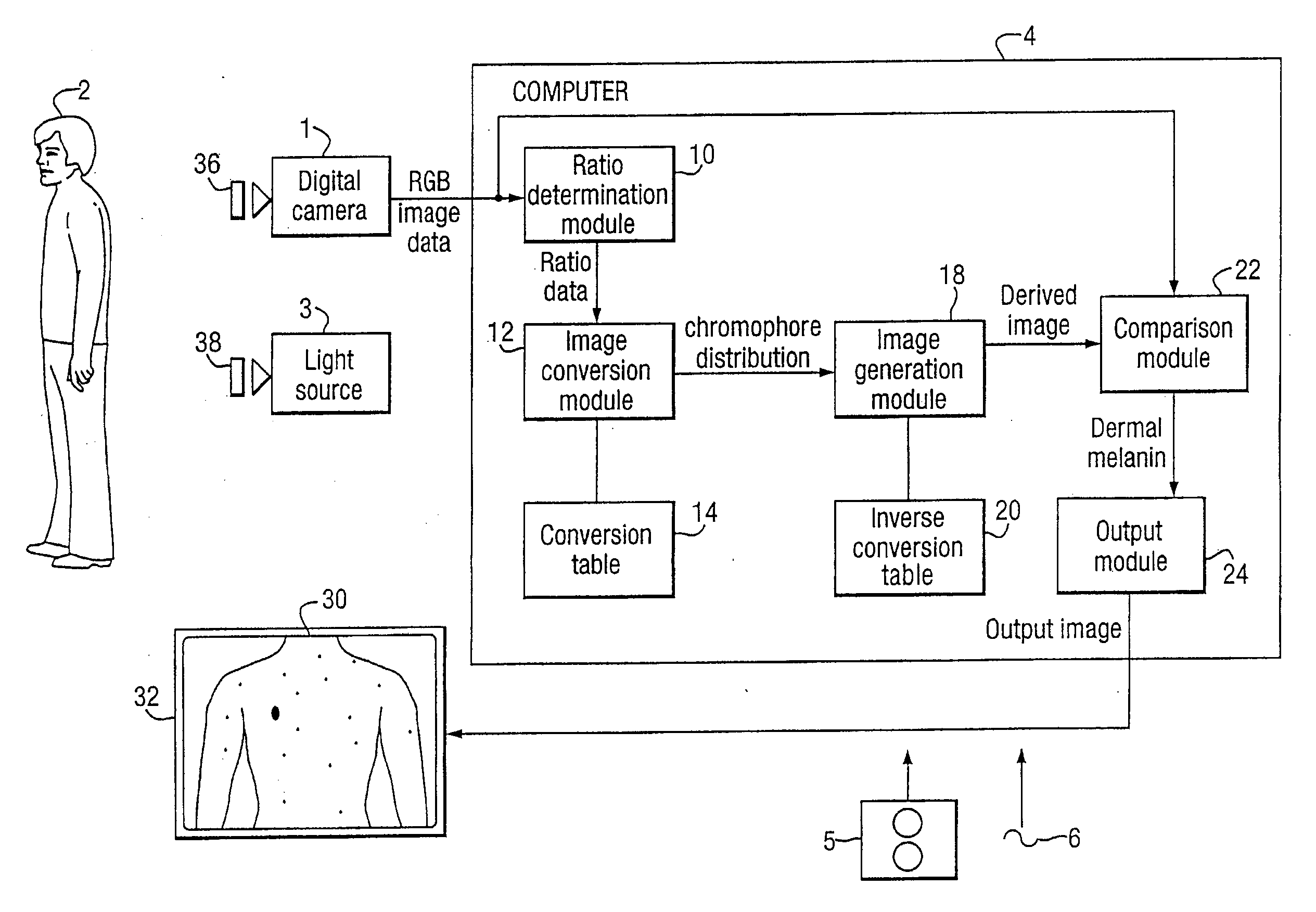 Method and Apparatus for Detecting the Presence of Dermal Melanin in Epithelial Tissue