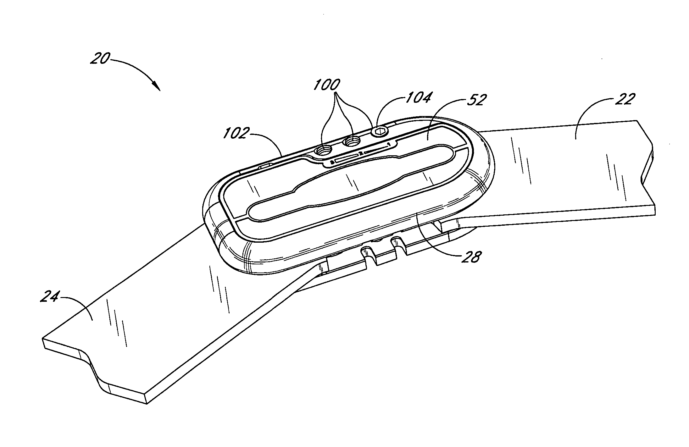 Motion controlling hinge for orthopedic brace