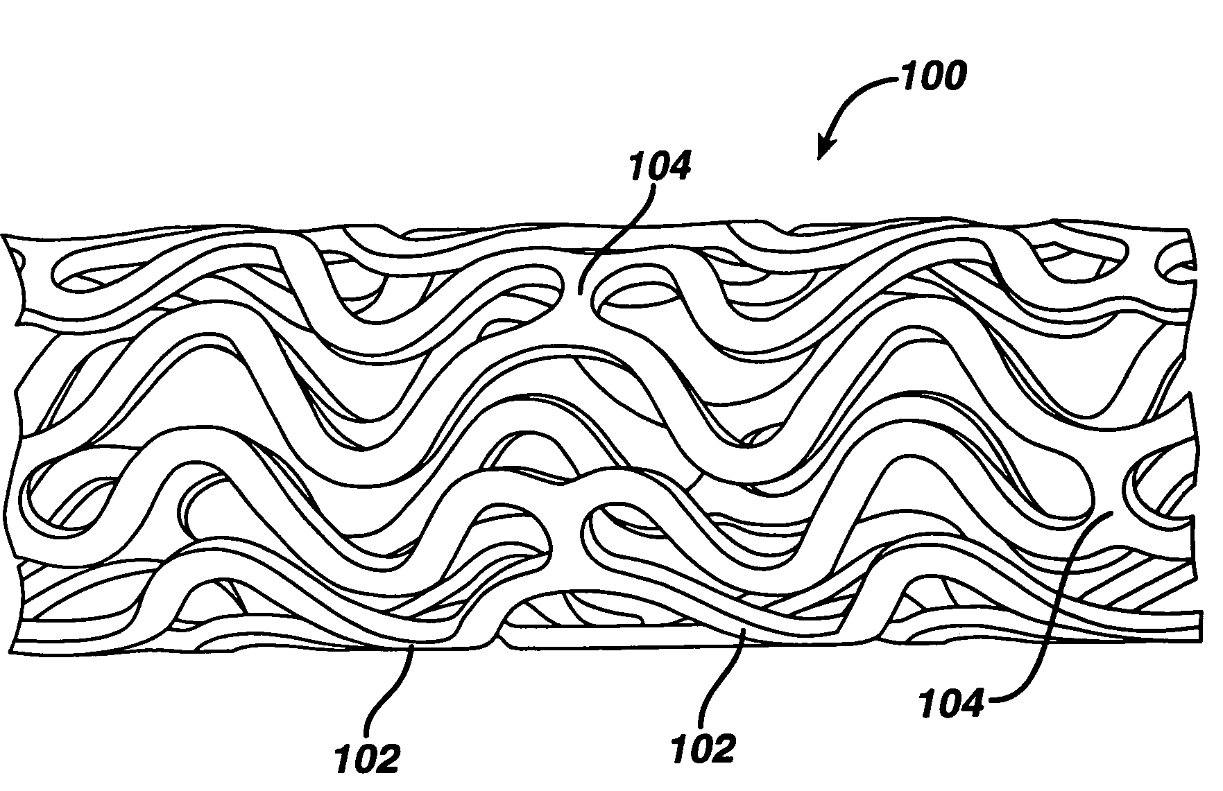 Drug/drug delivery systems for the prevention and treatment of vascular disease