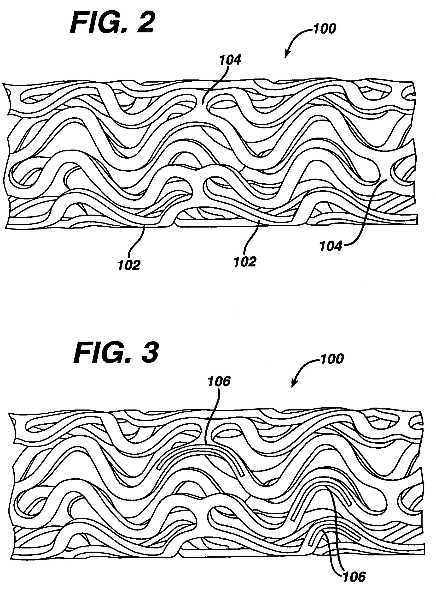 Drug/drug delivery systems for the prevention and treatment of vascular disease