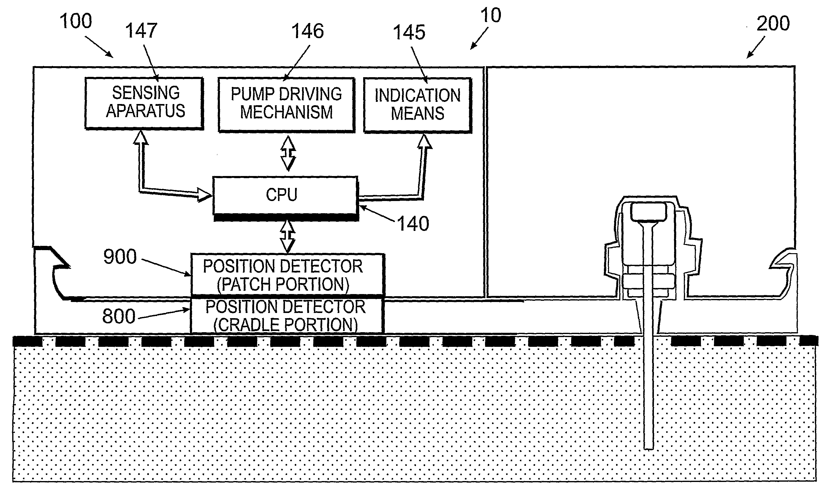 Detachable portable infusion device