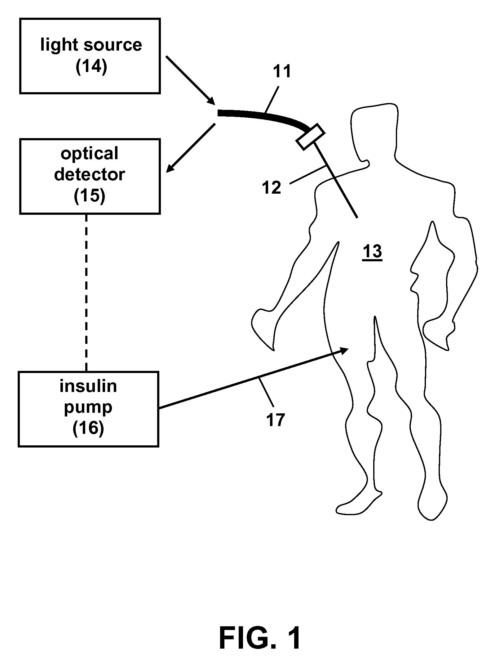 Indwelling Fiber Optic Probe for Blood Glucose Measurements