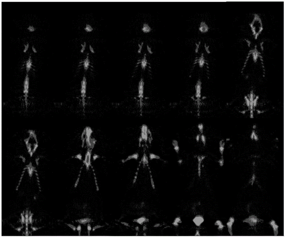 Mark product of &lt;89&gt;Zr marked denosumab, and preparation method and application thereof