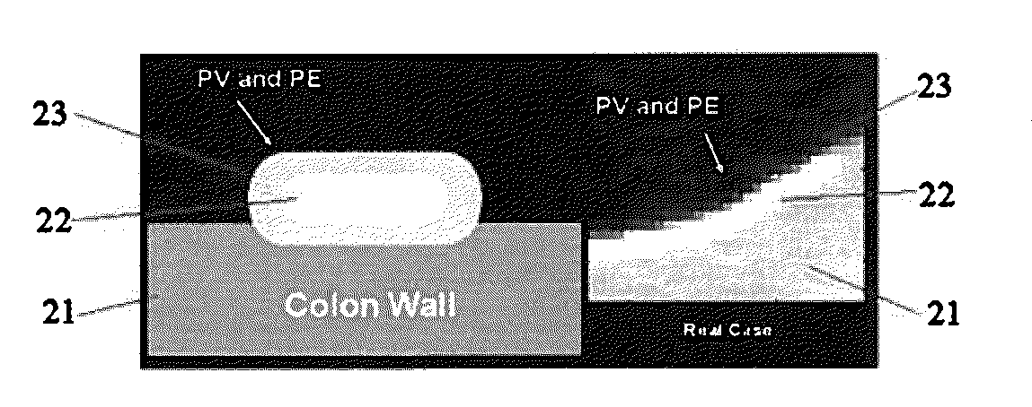 System and Method for Detecting Tagged Material Using Alpha Matting