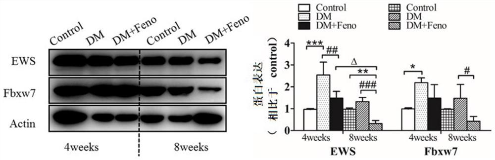 Application of up-regulator of hr or nhej pathway in preparation of medicines for treating diabetes and preventing tumor occurrence in diabetic individuals