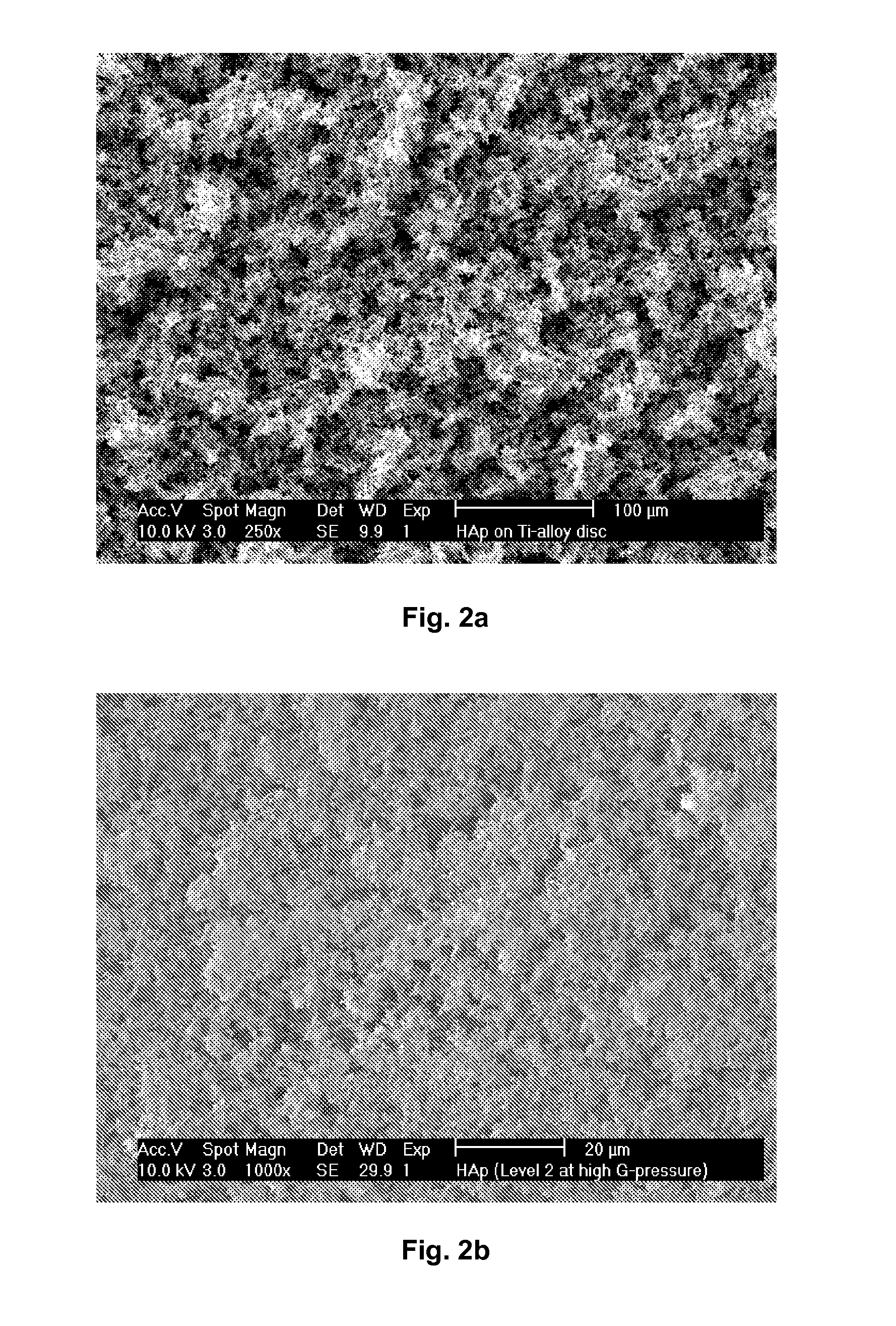 Nanostructured Hydroxyapatite Coating for Dental and Orthopedic Implants