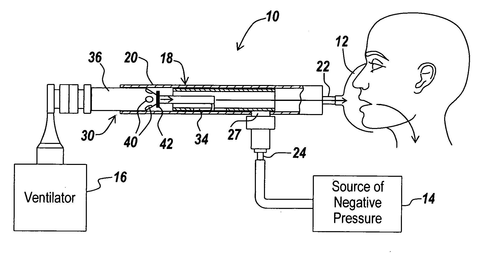 Inexsufflator