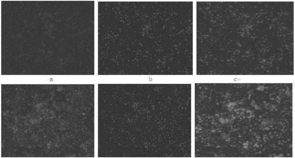 Amphipathic segmented copolymer micelle compound drug loading and delivery system and preparation method of brain-targeted water-soluble micelle